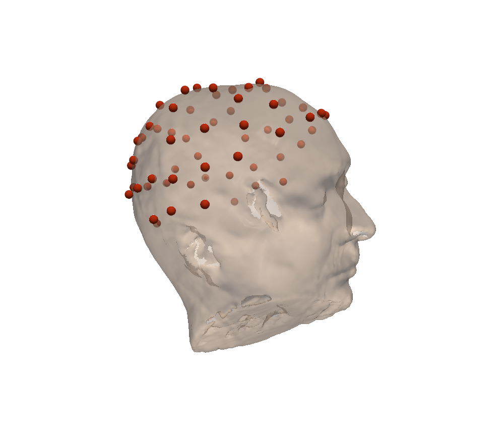 Electrodes (red) sitting on the subject's head surface after coregistration.