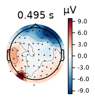 Peak topography once the epochs are averaged.