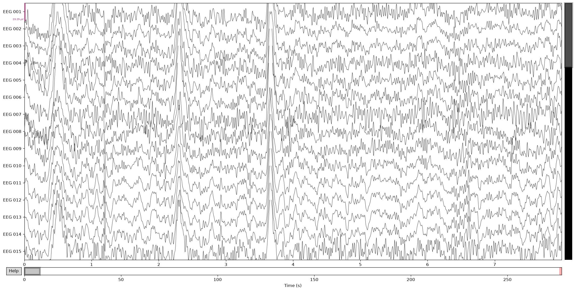 A segment of the continuous EEG after filtering.