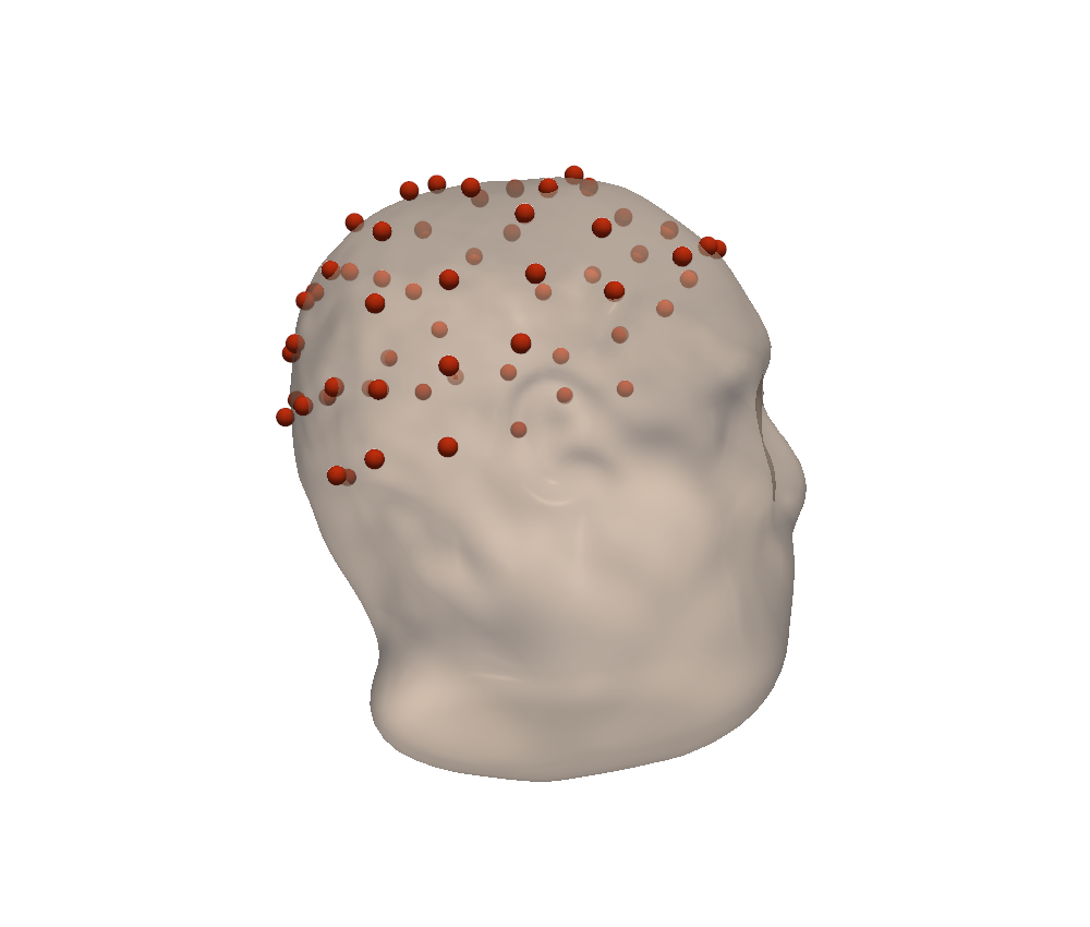 Electrodes (red) on the FreeSurfer skin surface after coregistration.