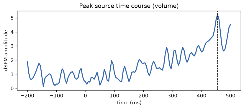 Time course of the strongest volume source.